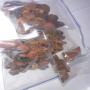  calcule de vesticule biliaire(cow gallstone)