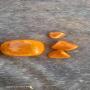 calcul vesticule biliaires ( cow gallstones )